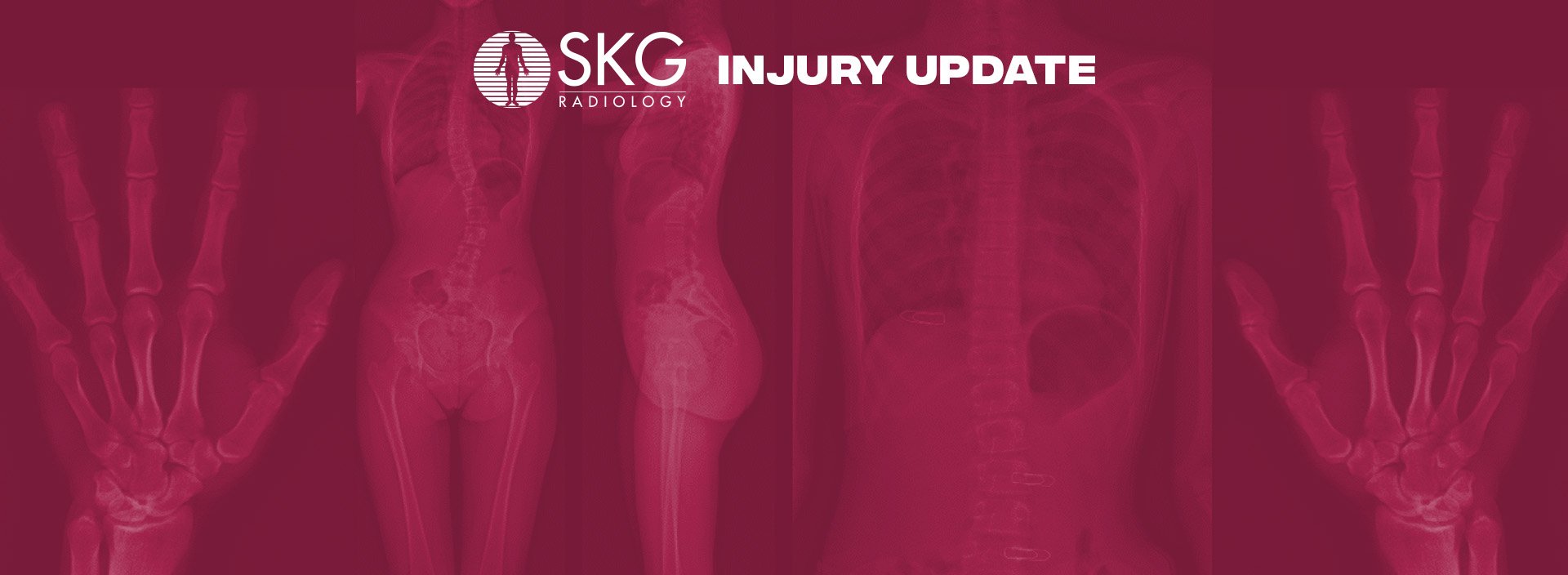 SKG Injury Update